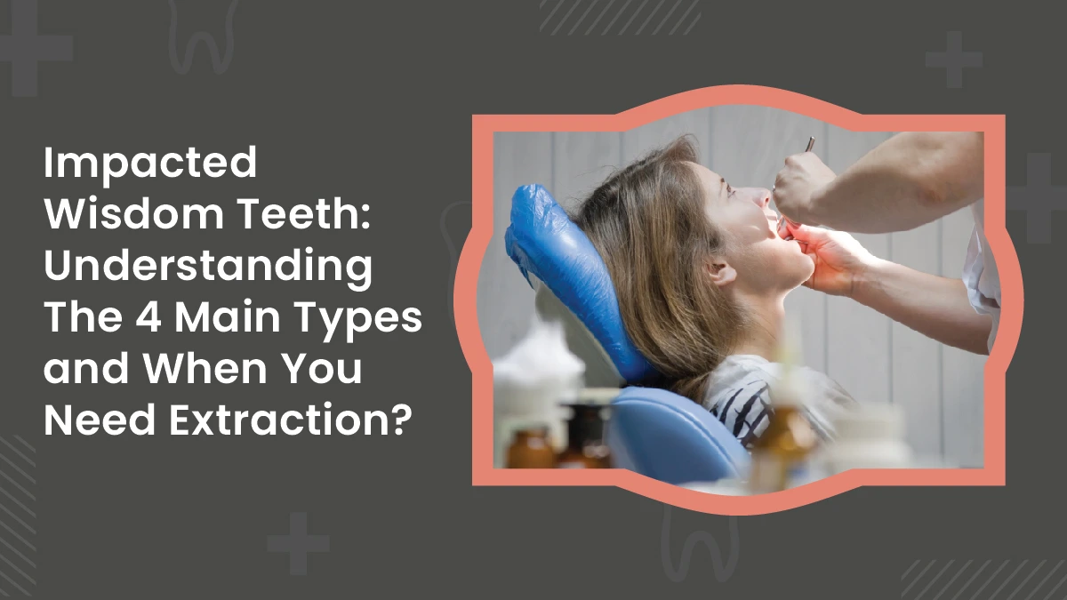 Impacted Wisdom Teeth: Types and When You Need Extraction
